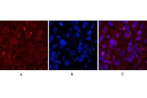 Immunofluorescence analysis of human breast cancer tissue. (Caspase 1 anticorps  (Cleaved-Asp210))