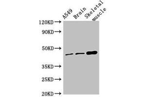 Western Blot Positive WB detected in: A549 whole cell lysate, Mouse brain tissue, Mouse skeletal muscle tissue All lanes: TMEM43 antibody at 4 μg/mL Secondary Goat polyclonal to rabbit IgG at 1/50000 dilution Predicted band size: 45 kDa Observed band size: 45 kDa (TMEM43 anticorps  (AA 178-312))