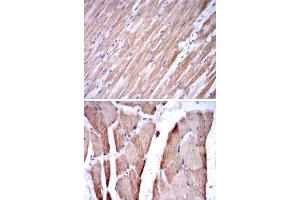 Immunohistochemical analysis of paraffin-embedded human cardiac muscle tissue (A) and striated muscle tissue (B) using TNNI2 monoclonal antobody, clone 2F12A8  with DAB staining. (TNNI2 anticorps)