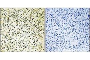 Immunohistochemistry analysis of paraffin-embedded human tonsil tissue, using NPM (Ab-234) Antibody.