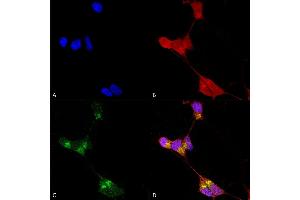 Immunocytochemistry/Immunofluorescence analysis using Mouse Anti-GABA-A Receptor Delta Monoclonal Antibody, Clone N151/3 (ABIN2485008).
