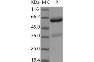 Western Blotting (WB) image for Tumor Necrosis Factor Receptor Superfamily, Member 11a, NFKB Activator (TNFRSF11A) protein (Fc Tag) (ABIN7198423)