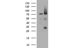 Image no. 1 for anti-Receptor (TNFRSF)-Interacting serine-threonine Kinase 1 (RIPK1) (AA 133-422) antibody (ABIN1490912)