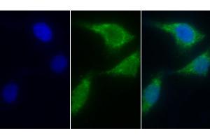 Detection of AIF in Human Hela cell using Polyclonal Antibody to Apoptosis Inducing Factor (AIF)