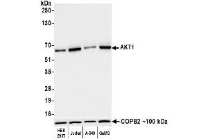 Western Blotting (WB) image for anti-V-Akt Murine Thymoma Viral Oncogene Homolog 1 (AKT1) (AA 100-150) antibody (ABIN7795633) (Recombinant AKT1 anticorps  (AA 100-150))