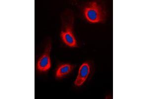 Immunofluorescent analysis of Caspase 3 staining in HeLa cells. (Caspase 3 anticorps  (Center))