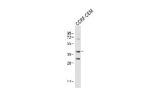 Anti-Mouse Nkx2-5 Antibody (Center) at 1:1000 dilution + CCRF-CEM whole cell lysate Lysates/proteins at 20 μg per lane. (NK2 Homeobox 5 anticorps  (AA 98-133))