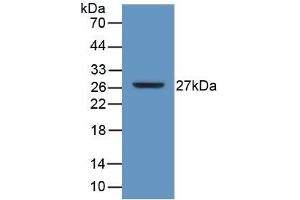 Detection of Recombinant ATP1b3, Human using Polyclonal Antibody to Sodium/potassium Transporting ATPase Subunit Beta-3 (ATP1b3) (ATP1B3 anticorps  (AA 61-273))