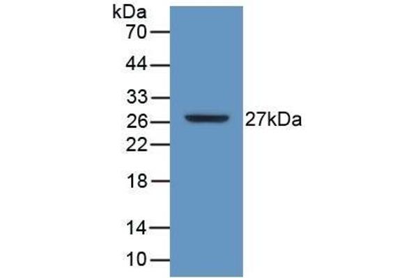 ATP1B3 anticorps  (AA 61-273)