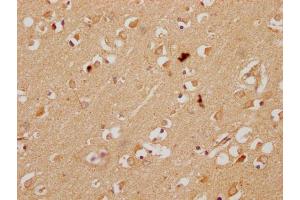 IHC image of ABIN7157259 diluted at 1:200 and staining in paraffin-embedded human brain tissue performed on a Leica BondTM system. (KBTBD7 anticorps  (AA 475-684))