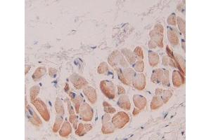 Used in DAB staining on fromalin fixed paraffin- embedded skin tissue (GSTT1 anticorps  (AA 7-231))