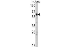 Western blot analysis of Hsp 60 Antibody (N-term) in mouse lung tissue lysates (35ug/lane). (HSPD1 anticorps  (N-Term))