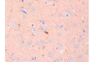 Used in DAB staining on fromalin fixed paraffin- embedded kidney tissue