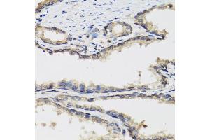 Immunohistochemistry of paraffin-embedded human prostate using PLA2G7 antibody. (PLA2G7 anticorps)