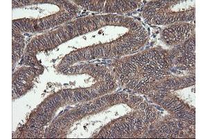 Image no. 5 for anti-Mitogen-Activated Protein Kinase Kinase 1 (MAP2K1) antibody (ABIN1499394) (MEK1 anticorps)