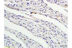 Formalin-fixed and paraffin embedded rat myocardium tissue labeled with Anti- PDGF-BB Polyclonal Antibody, Unconjugated (ABIN674874) followed by conjugation to the secondary antibody and DAB staining (PDGF-BB Homodimer (AA 151-241) anticorps)