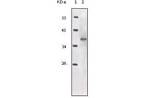 Western blot analysis using IGF1R mouse mAb against truncated IGF1R recombinant protein. (IGF1R anticorps)
