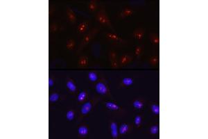 Immunofluorescence analysis of U2OS cells using SIRT7 Rabbit pAb (ABIN3021210, ABIN3021211, ABIN3021212 and ABIN6214068) at dilution of 1:50 (40x lens). (SIRT7 anticorps  (AA 201-400))