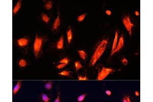 Immunofluorescence analysis of U-2 OS cells using ARL4A Polyclonal Antibody at dilution of 1:100.