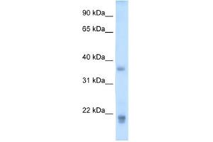 WB Suggested Anti-GH2 Antibody Titration:  5. (Growth Hormone 2 anticorps  (Middle Region))