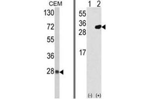 (LEFT) Western blot analysis of PRDX6 Antibody (C-term) in CEM cell line lysates (35ug/lane). (Peroxiredoxin 6 anticorps  (C-Term))