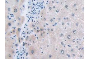 Detection of NCCT in Human Liver Tissue using Polyclonal Antibody to Na-Cl Cotransporter (NCCT)