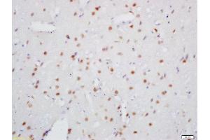 Formalin-fixed and paraffin embedded rat brain labeled with Rabbit Anti-SOX10 Polyclonal Antibody, Unconjugated (ABIN1386776) at 1:200 followed by conjugation to the secondary antibody and DAB staining (SOX10 anticorps)