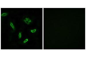 Immunofluorescence (IF) image for anti-Solute Carrier Family 27 (Fatty Acid Transporter), Member 5 (SLC27A5) (Internal Region) antibody (ABIN1850922) (SLC27A5 anticorps  (Internal Region))