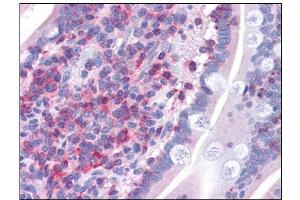 Human Small Intestine: Formalin-Fixed, Paraffin-Embedded (FFPE) (FNBP1 anticorps  (Internal Region))