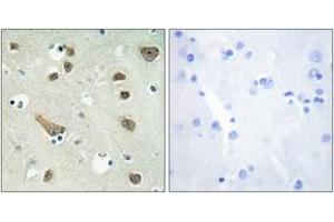 Immunohistochemistry analysis of paraffin-embedded human brain tissue, using 14-3-3 gamma Antibody. (14-3-3 gamma anticorps  (AA 51-100))