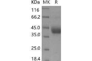 Western Blotting (WB) image for ADP-Ribosyltransferase 4 (Dombrock Blood Group) (ART4) protein (His tag) (ABIN7320048)