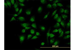 Immunofluorescence of monoclonal antibody to CLK3 on HeLa cell. (CLK3 anticorps  (AA 36-136))