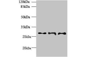 Western blot All lanes: BARX1 antibody at 6 μg/mL Lane 1: Hela whole cell lysate Lane 2: Jurkat whole cell lysate Lane 3: CEM whole cell lysate Secondary Goat polyclonal to rabbit IgG at 1/10000 dilution Predicted band size: 28, 12 kDa Observed band size: 28 kDa (BARX1 anticorps  (AA 1-100))