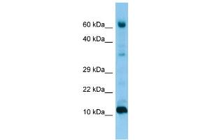 WB Suggested Anti-FABP9 Antibody Titration: 1. (FABP9 anticorps  (Middle Region))