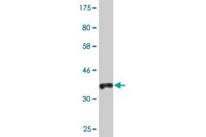 Western Blot detection against Immunogen (37.