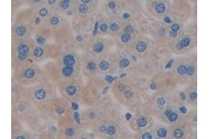 Detection of PDL1 in Mouse Liver Tissue using Polyclonal Antibody to Programmed Cell Death Protein 1 Ligand 1 (PDL1) (PD-L1 anticorps  (AA 48-290))