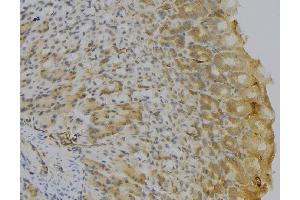 ABIN6277150 at 1/100 staining Human gastric tissue by IHC-P. (HLA-DQA1 anticorps)