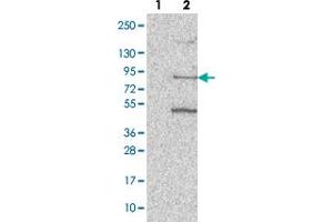 Western blot analysis of Lane 1: Negative control (vector only transfected HEK293T lysate). (PATL1 anticorps)