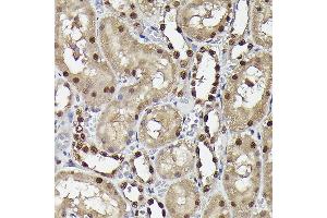 Immunohistochemistry of paraffin-embedded rat stomach using SQSTM1/p62 Rabbit pAb (ABIN6128552, ABIN6148419, ABIN6148425 and ABIN6223705) at dilution of 1:100 (40x lens).