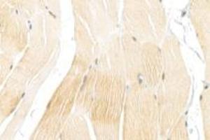 Immunohistochemistry analysis of paraffin-embedded rat skin using,alpha Actinin (ABIN7073023) at dilution of 1: 900 (alpha Actinin anticorps)