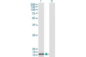 Western Blot analysis of S100A7 expression in transfected 293T cell line by S100A7 monoclonal antibody (M07A), clone 3E11. (S100A7 anticorps  (AA 1-101))