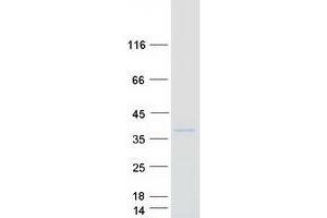 Validation with Western Blot