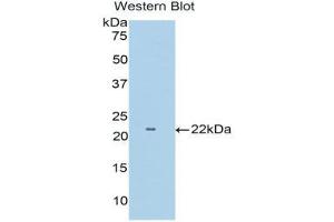 Western Blotting (WB) image for anti-Tumor Necrosis Factor Receptor Superfamily, Member 1B (TNFRSF1B) (AA 303-474) antibody (ABIN3206519) (TNFRSF1B anticorps  (AA 303-474))