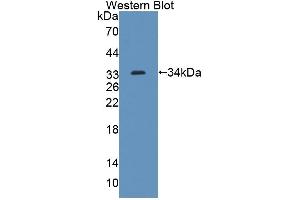 Detection of Recombinant ABCG8, Mouse using Polyclonal Antibody to ATP Binding Cassette Transporter G8 (ABCG8)