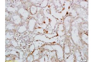 Formalin-fixed and paraffin embedded rat colitis tissue labeled with Rabbit Anti-L-Selectin/CD62L Polyclonal Antibody , Unconjugated 1:200 followed by conjugation to the secondary antibody and DAB staining