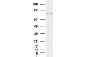 Validation with Western Blot