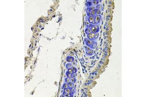 Immunohistochemistry of paraffin-embedded mouse lung using SKP1 antibody at dilution of 1:100 (x40 lens). (SKP1 anticorps)