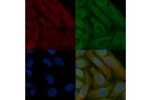 Peroxiredoxin 5 Mouse Monoclonal Antibody staining Hela cells by IF/ICC. (Peroxiredoxin 5 anticorps  (C-Term))