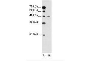 Image no. 1 for anti-Pre-B-Cell Leukemia Homeobox Protein 1 (PBX1) (N-Term) antibody (ABIN6736594) (PBX1 anticorps  (N-Term))