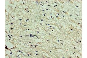 Immunohistochemistry of paraffin-embedded human brain tissue using ABIN7150554 at dilution of 1:100